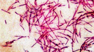NYC Legionnaires' outbreak: source eliminated as cases near 100