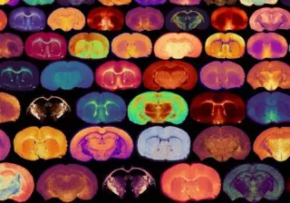 Glucose Signals Turn On the Brain’s Myelin Growth Timeline