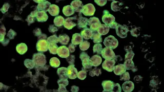 NC Teen Dies From Rare Brain-Eating Amoeba Linked to Warm Freshwater