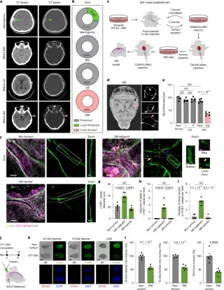 Cancer-Driven Osteoclasts Disrupt Meningeal Lymphatics to Suppress Immunity in Dural Metastasis