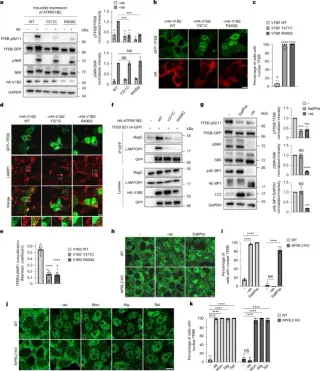 New Lysosomal Pathway Links TBK1 Signaling to Follicular Lymphoma Proliferation
