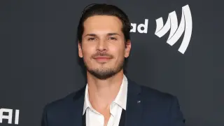 Gleb Savchenko Takes a Season 35 Break, Eyes Acting Career