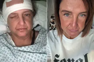 From Cold Remedy to Critical Care: Brit's Meningitis Ordeal After Painkiller Advice