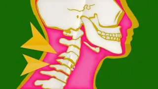 Screen posture quadruples neck load; surgeon outlines five exercises to counter modern strain