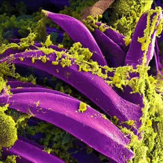 Russia Denies Plague Lab Accident as US Monitors Death of Siberian Researcher