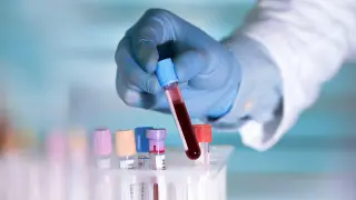 AI-Designed Drug Shows Early Promise in Slowing Aging