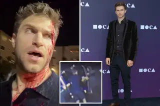 Actor Keegan Allen Assaulted in West Hollywood, Challenges LA Leaders on Surveillance Tech