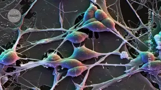 Sex-Specific Gene Activity Mapped Across Brain Cells