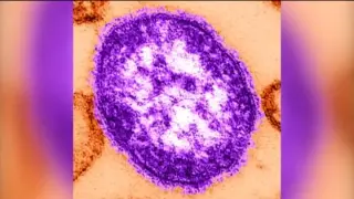 Philadelphia Health Warns of Second Measles Exposure at PHL, Urges Vaccination