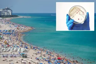 Florida Elder Dies From Flesh-Eating Vibrio, First 2026 US Fatality