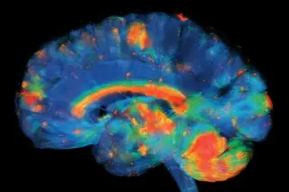 Orexin Neurons Gate Sustained Motivation, Study Finds