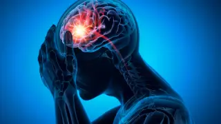 Tiny brain vessels drive a common stroke, reshaping prevention
