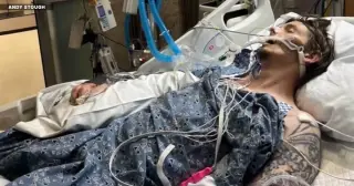 Palm Beach County man survives flesh-eating infection after 101-day hospital ordeal