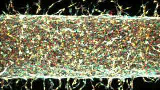 MIT magnets pattern lab-grown blood vessels