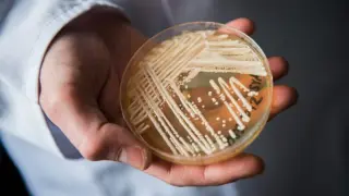 Hospitals on alert as Candida auris spreads and resists treatment