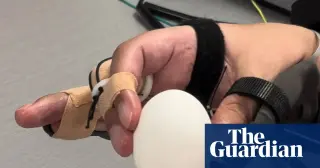 Brain-Computer Interface Restores Movement and Touch in Paralyzed Man