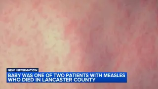 Lancaster County measles deaths include infant among two unvaccinated patients