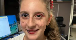 Blue-Tinted Contacts Cut Sunflower Syndrome Seizures in Teen