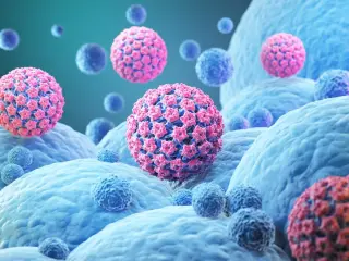 Infections Linked to 2.3 Million Global Cancer Cases in 2024