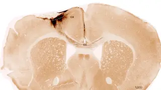 Neural Stem Cells Rebuild Stroke-Damaged Brain and Restore Movement in Mice