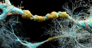 New molecule shows early potential to repair myelin in MS