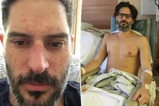 Manganiello Reveals Graphic Hospital Photos from 2016 Intestine Removal Amid Memoir Fallout