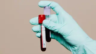 Blood Test pTau217 Signals Alzheimer's Risk Years Before Symptoms