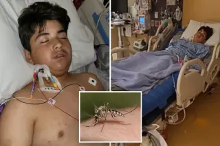 Long Beach Teen Paralyzed by Rare West Nile Complication Amid Record County Surge