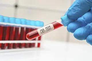 Could a Simple Blood Test Reveal Hidden Heart Risk in Healthy People?