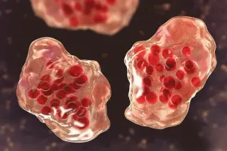 Finger Lakes measles alert prompts regional health response