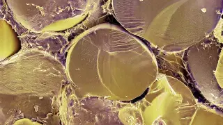 Mitch protein switch makes human cells burn fats for energy, opening obesity research avenue