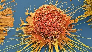 Light-Activated Molecular Jackhammer Destroys 99% of Cancer Cells in Lab