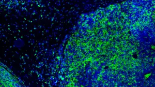 OX40 immunotherapy shows responses in head and neck cancer, strongest in HPV-positive tumors