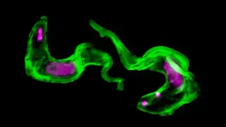 ESB2, the parasite's molecular shredder, unravels sleeping sickness cloak mystery