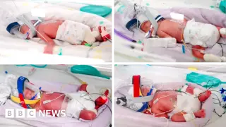 Australian mom delivers ultra-rare identical quadruplets