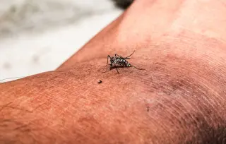 Dengue Fever Reaches Florida as Local Mosquito Transmission Triggers Health Alerts