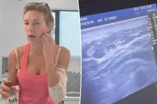 Brandi Glanville Reveals Shocking Ultrasound Find in Her Face Amid Health Battle