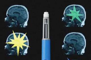 GLP-1 medications may reshape brain circuits, early scans show
