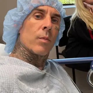Travis Barker Recovers from Nerve Surgery to Protect Drumming Career