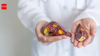 Small Weight Loss, Big Liver Revival: The Urgent Case for Early Fatty Liver Intervention