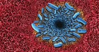 Florida records first flesh-eating bacteria fatality of 2026 amid warm-water exposure