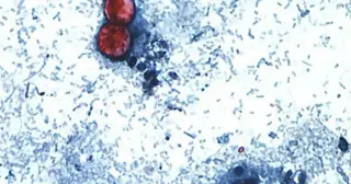 Johnson County drives Kansas cyclosporiasis surge linked to produce contamination