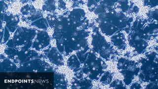 Glioblastoma Vaccine SurVaxM Misses Primary Goal but Shows Promise in Younger Patients