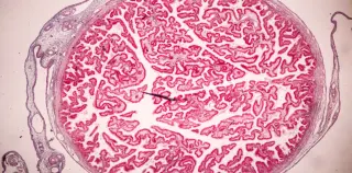 Placenta Rights: Why Birth Plans Should Include Disposal Choices