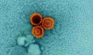 Dormant viruses reawaken in severe COVID, fueling long COVID and autoimmune risks