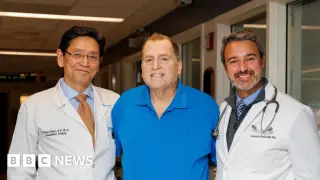 Genetically engineered pig kidney sustains patient for 271 days as transplant bridge
