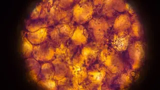 Obesity Leaves a Lasting Imprint in Fat-Cell Immune Cells, Slowing Weight Loss
