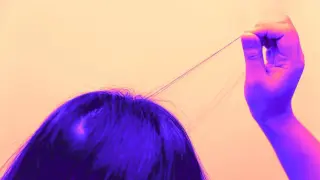 Urges and Boredom Fuel Hair-Pulling in Trichotillomania, Study Finds