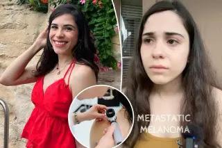 Texas woman’s melanoma warning: early skin checks could have saved her life