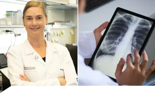 Early screening and genomic profiling reshape lung cancer care